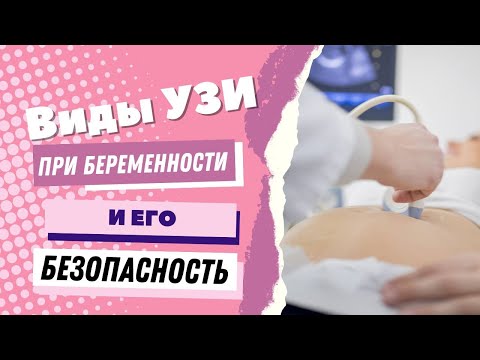 Видео: Виды УЗИ при беременности и его безопасность @DrOlenaB