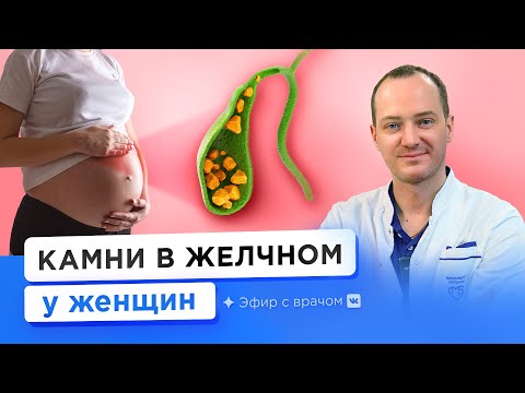 Видео: Как удаляют желчный пузырь беременным? Желчнокаменная болезнь во время беременности и после родов 
