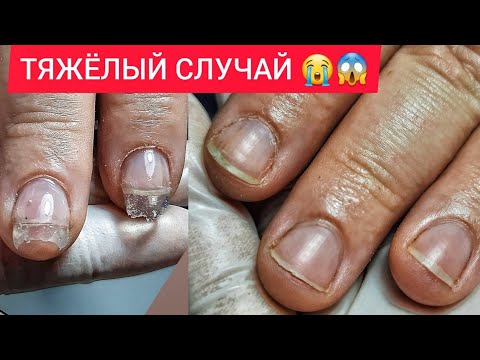 Видео: НУ НАКОНЕЦ-ТО😱🥳ИДЕАЛЬНЫЙ КЛИЕНТ❤ ПРЕОБРАЖЕНИЕ НОГТЕЙ😻НАРАЩИВАНИЕ АРОЧНЫЙ КВАДРАТ