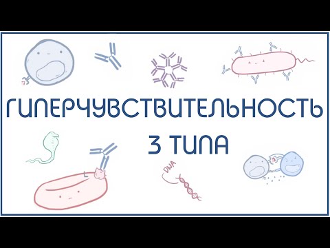 Видео: Гиперчувствительность 3 типа (иммунокомплексный) - механизм и примеры реализации