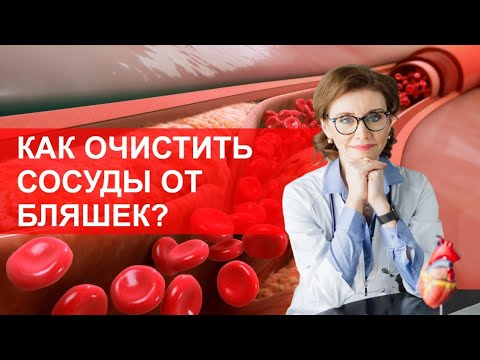 Видео: Как очистить сосуды от холестериновых бляшек?