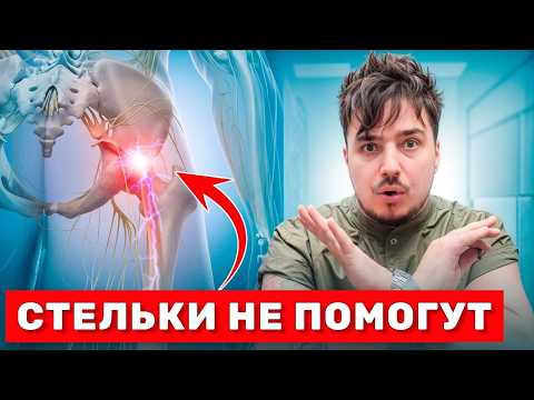 Видео: Плоскостопие = БОЛЬ ❌ Почему стельки не помогают