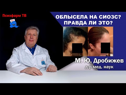 Видео: Облысела на СИОЗС? Правда ли это?