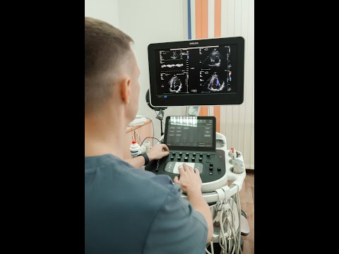 Видео: УЗИ сердца (ЭХОКГ) после двух инфарктов.