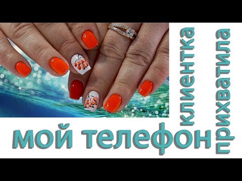 Видео: Трапецевидные ногти. Казус на работе )