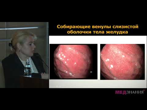Видео: 02 Эндоскопия на полях Маастрихта 5  Bene dignoscitur – bene curator