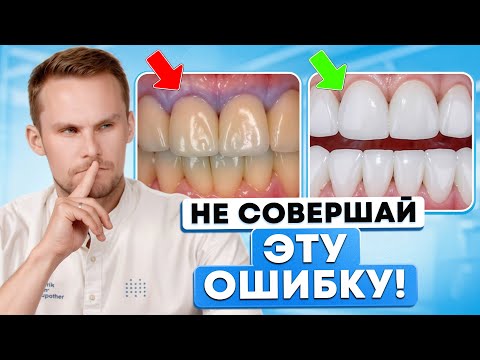 Видео: МЕТАЛЛОКЕРАМИКА или ЦИРКОНИЙ? Какую коронку ВЫБИРАЮТ СТОМАТОЛОГИ?