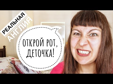 Видео: СЛОМАЛА ЗУБ: СТОМАТОЛОГИЯ В АНГЛИИ: ОБДЕРУТ КАК ЛИПКУ? ♥ РЕАЛЬНАЯ ВЕЛИКОБРИТАНИЯ ♥
