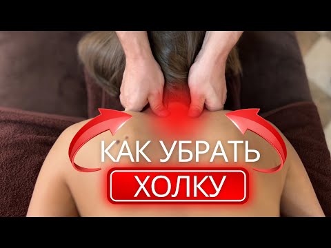 Видео: Вдовий ГОРБ | КАК ИЗБАВИТЬСЯ от холки на шее НАВСЕГДА