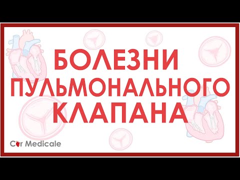 Видео: Болезни пульмонального клапана: стеноз и регургитация/недостаточность клапана.