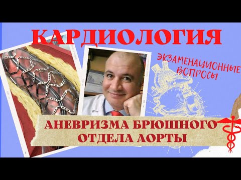 Видео: АНЕВРИЗМА брюшного отдела АОРТЫ. Как ответить на ЭКЗАМЕНЕ?