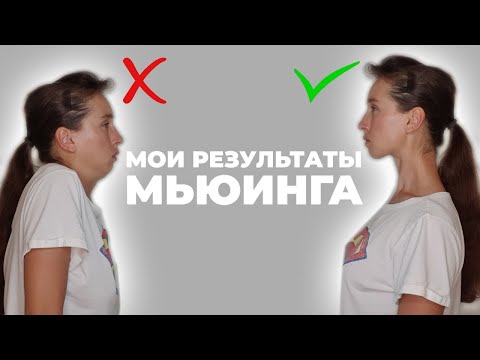 Видео: Мьюинг: как правильно держать язык для красоты и молодости лица. Мои mewing - результаты