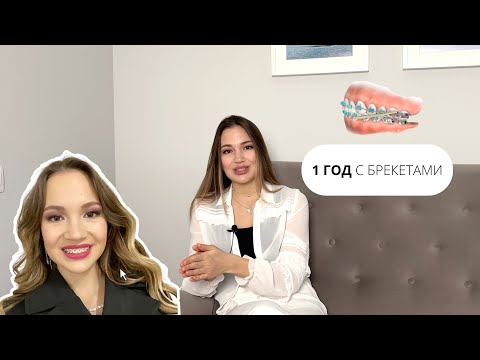 Видео: 1 ГОД С БРЕКЕТАМИ 🦷 НАЛОГОВЫЙ ВЫЧЕТ 💰 ИМПЛАНТ