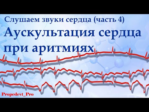 Видео: Слушаем звуки сердца (4). Аускультация сердца при аритмиях