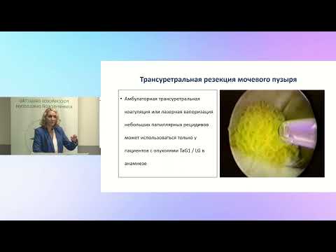 Видео: Принципы лечения немышечно-инвазивного уротелиального рака мочевого пузыря