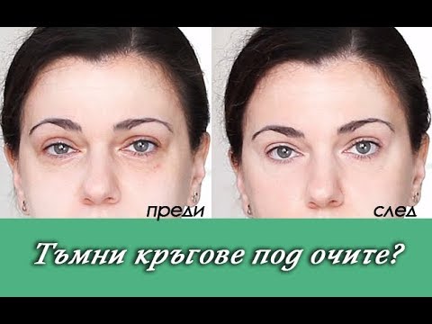 Видео: Тъмни кръгове под очите? Как да се справим с тях, как да ги прикриваме успешно - GitaR