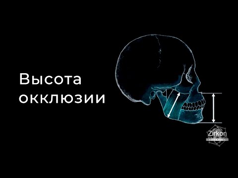 Видео: Высота окклюзии и способы определения. Видео для стоматологов и зубных техников от ZIRKON LAB