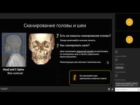 Видео: Пан КТ при политравме, акценты для рентгенолаборанта