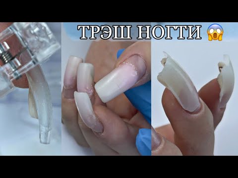 Видео: Oopss трешовая коррекция/как исправить ногти -коршуны