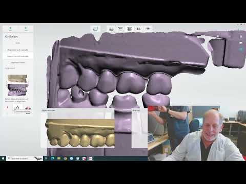 Видео: Сканирование Crown Lab