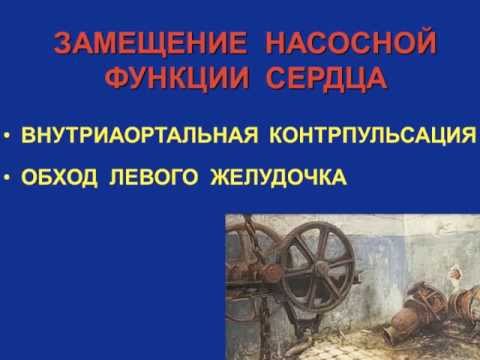 Видео: ОИМ кардиогенный шок часть 2 Кошкина Е.В