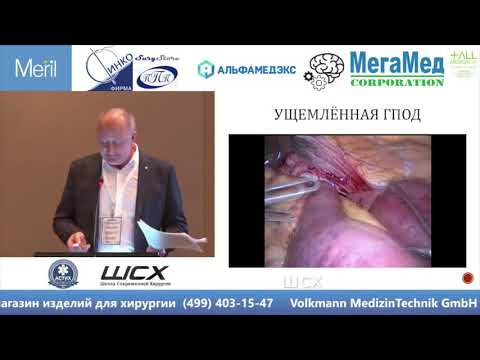 Видео: Ерин С. Тонкости и уловки в экстренной лапароскопии