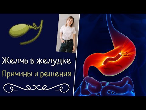 Видео: Желчь в желудке. Причины и решения