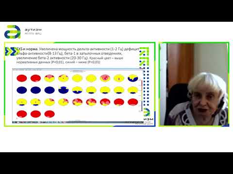 Видео: 3 - "Нейрофизиологические исследования лиц с FXS"
