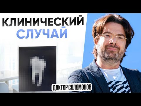 Видео: клинический случай