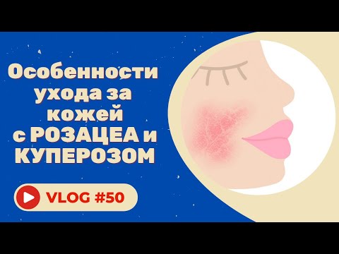 Видео: #50 Особенности ухода за кожей с розацеа и куперозом