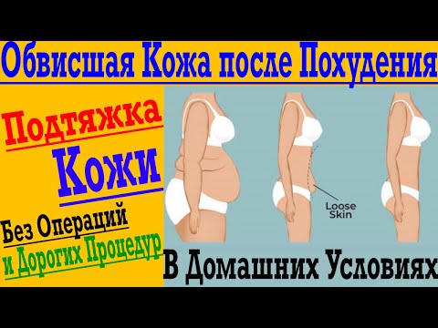 Видео: Как подтянуть обвисшую кожу после похудения, родов или возрастных изменений !