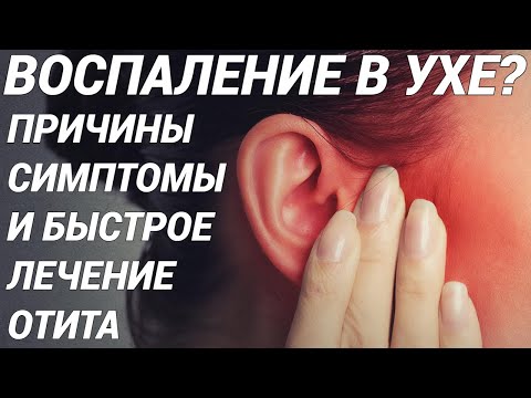 Видео: ОТИТ - ВОСПАЛЕНИЕ УХА: симптомы, причины, лечение! Как определить вид отита и правильно лечить?