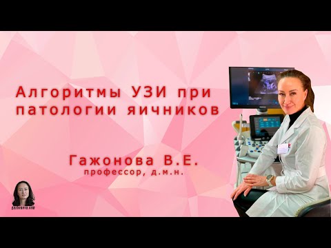 Видео: Алгоритмы УЗИ при патологии яичников. Профессор Гажонова В.Е.