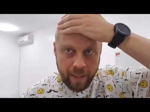 Видео: Вторая неделя после пересадки волос