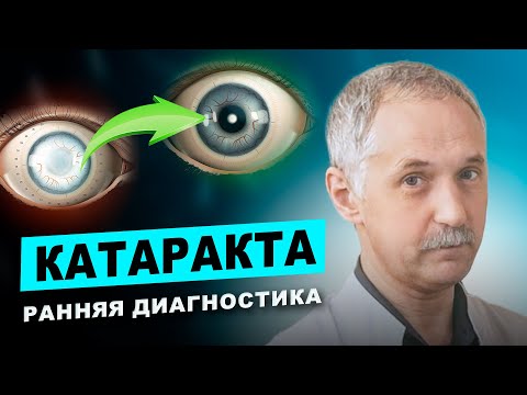 Видео: Катаракта: Симптомы, которые вы не должны игнорировать! / Доктор Виктор