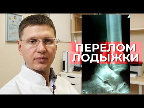 Видео: Как лечить перелом лодыжек? Профилактика тромбоэмболий