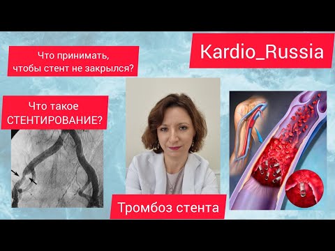 Видео: 🫀 Что пить из лекарств, чтобы стент не закрылся? Стентирование - это надолго?