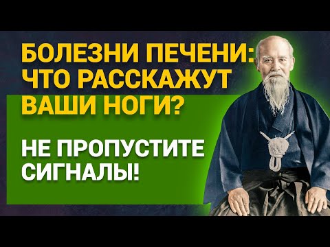 Видео: Болезни печени: что расскажут ваши ноги? Не пропустите сигналы!