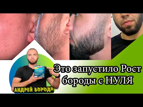 Видео: Это поможет запустить рост бороды с нуля / Андрей Борода / Выпуск №1 "Как отрастить бороду"