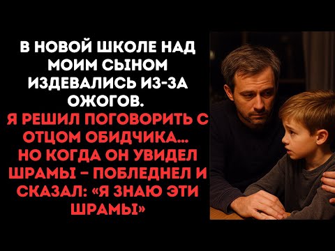Видео: В новой школе над моим сыном издевались из-за ожогов. Я решил поговорить с отцом обидчика…