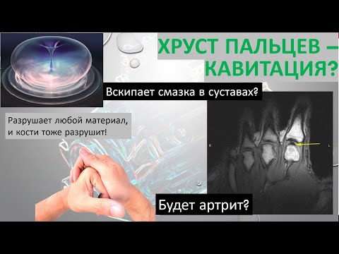 Видео: Хруст пальцев. И причём здесь кавитация?