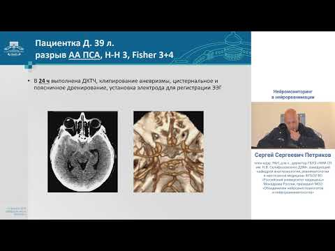 Видео: Нейромониторинг в нейрореанимации Петриков С.С.
