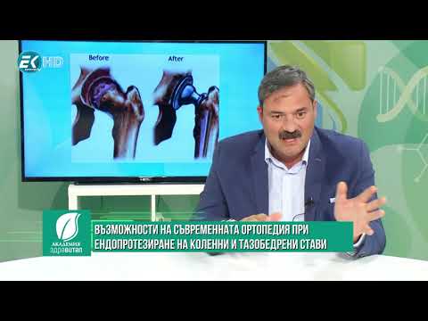 Видео: Възможности на съвременната ортопедия при ендопротезиране на коленни и тазобедрени стави 2/3