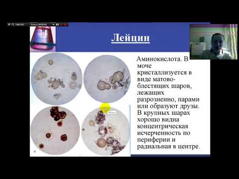 Видео: Исследование мочи
