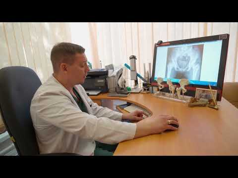 Видео: НМИЦ им. Г. И. Турнера: новый подход в лечении дисплазии тазобедренного сустава у детей