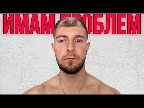 Видео: ОПЛЕШИВЯВАМ НА 26 ГОДИНИ