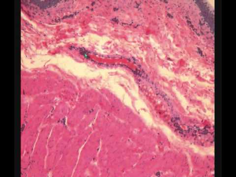 Видео: МОЧЕВОЙ ПУЗЫРЬ  гистологическое строение   URINARY BLADDER