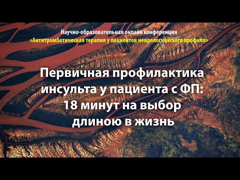 Видео: Первичная профилактика инсульта у пациента с ФП: 18 минут на выбор длиною в жизнь