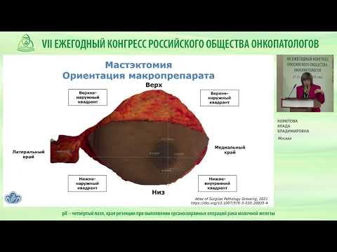Видео: pR – четвёртый пазл, оценка статуса краев резекции