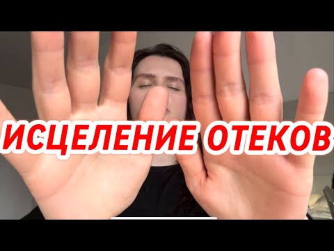 Видео: ИСЦЕЛЕНИЕ ❤️‍🩹 ОТЕКОВ/Healing oedema
